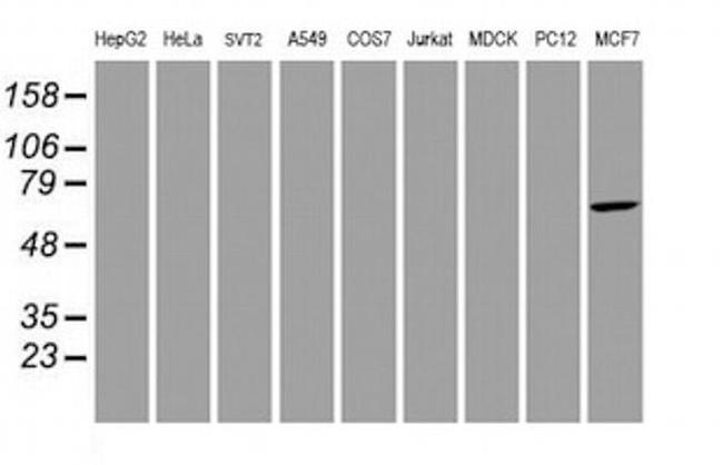 AIPL1 Antibody in Western Blot (WB)