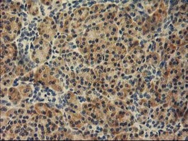 TBC1D21 Antibody in Immunohistochemistry (Paraffin) (IHC (P))