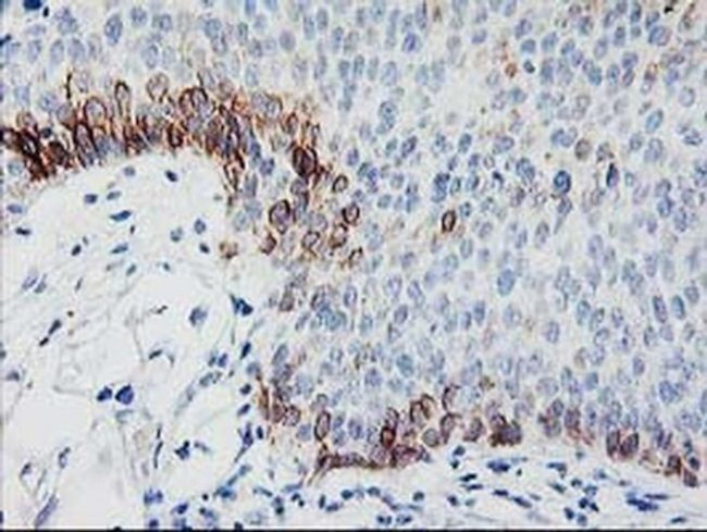 TBC1D21 Antibody in Immunohistochemistry (Paraffin) (IHC (P))