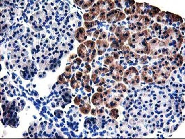 TBC1D21 Antibody in Immunohistochemistry (Paraffin) (IHC (P))