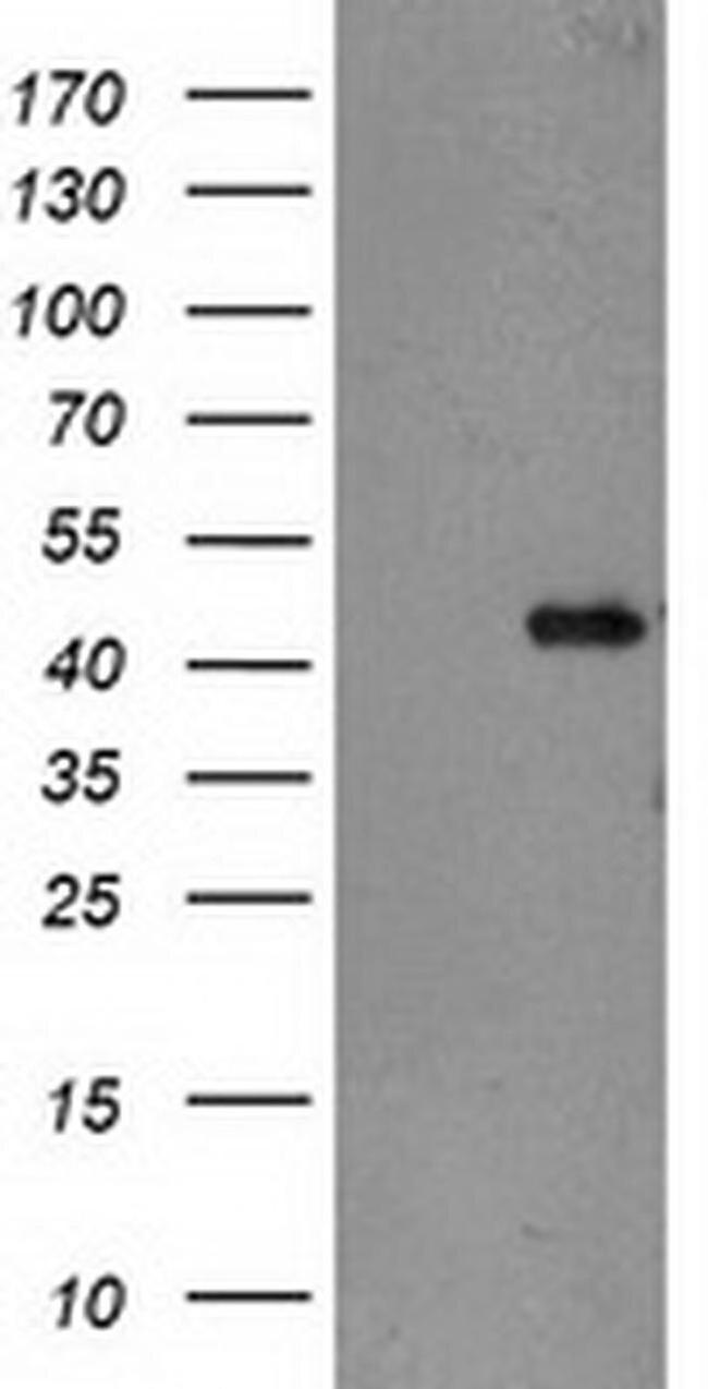 TBC1D21 Antibody in Western Blot (WB)