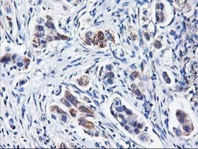 HARS2 Antibody in Immunohistochemistry (Paraffin) (IHC (P))