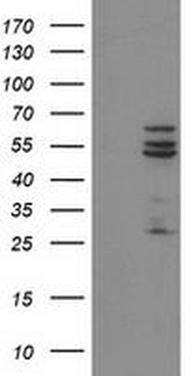 CYP2C9 Antibody in Western Blot (WB)