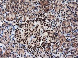 NUDT18 Antibody in Immunohistochemistry (Paraffin) (IHC (P))