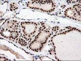 NUDT18 Antibody in Immunohistochemistry (Paraffin) (IHC (P))