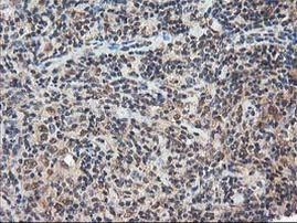 NUDT18 Antibody in Immunohistochemistry (Paraffin) (IHC (P))