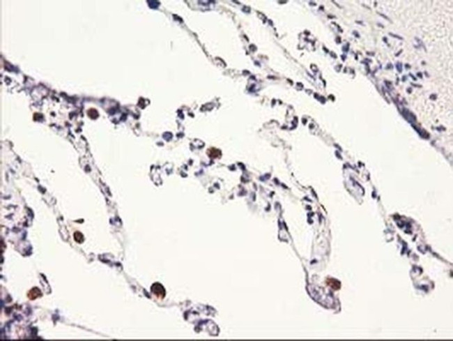 HARS2 Antibody in Immunohistochemistry (Paraffin) (IHC (P))