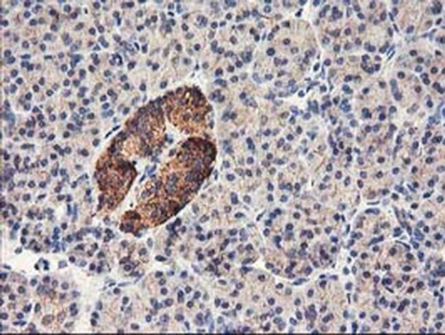 HARS2 Antibody in Immunohistochemistry (Paraffin) (IHC (P))