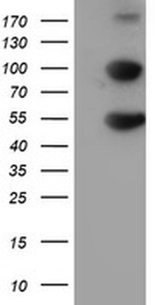 HARS2 Antibody in Western Blot (WB)