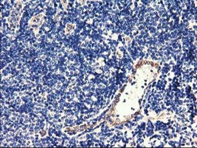 CENPH Antibody in Immunohistochemistry (Paraffin) (IHC (P))