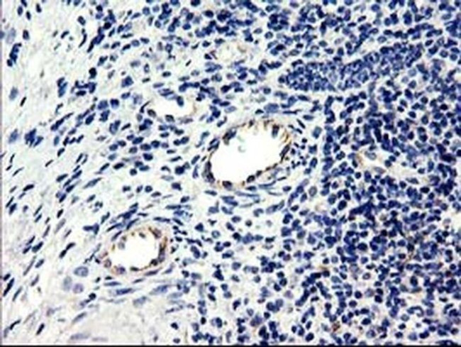 CENPH Antibody in Immunohistochemistry (Paraffin) (IHC (P))