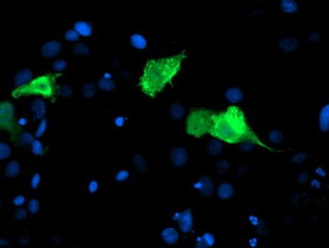 CENPH Antibody in Immunocytochemistry (ICC/IF)