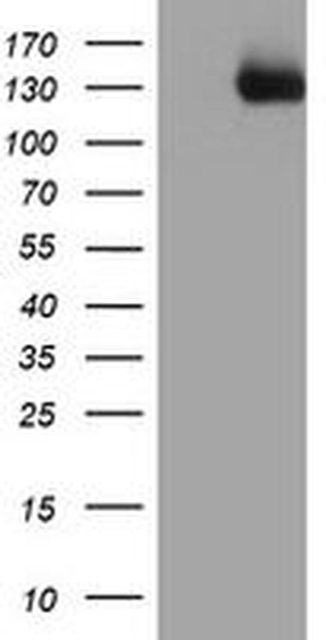 PTK7 Antibody in Western Blot (WB)