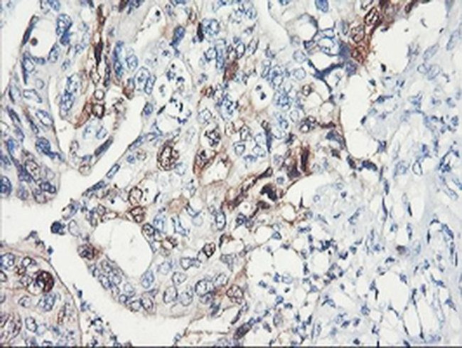 SERPINB2 Antibody in Immunohistochemistry (Paraffin) (IHC (P))