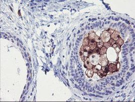 SDS Antibody in Immunohistochemistry (Paraffin) (IHC (P))