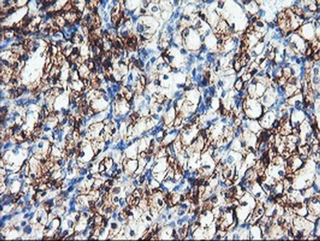 CD249 Antibody in Immunohistochemistry (Paraffin) (IHC (P))