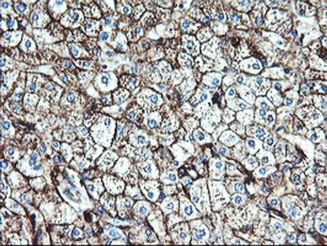 CD249 Antibody in Immunohistochemistry (Paraffin) (IHC (P))