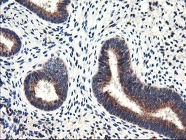 CD249 Antibody in Immunohistochemistry (Paraffin) (IHC (P))