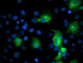 PFKP Antibody in Immunocytochemistry (ICC/IF)