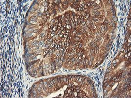 PFKP Antibody in Immunohistochemistry (Paraffin) (IHC (P))