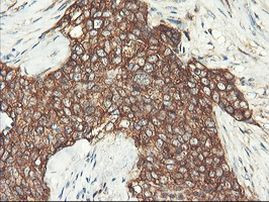 PFKP Antibody in Immunohistochemistry (Paraffin) (IHC (P))