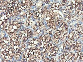 PFKP Antibody in Immunohistochemistry (Paraffin) (IHC (P))