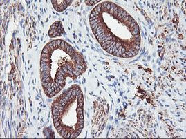 PFKP Antibody in Immunohistochemistry (Paraffin) (IHC (P))