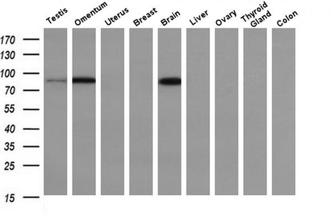 PFKP Antibody in Western Blot (WB)