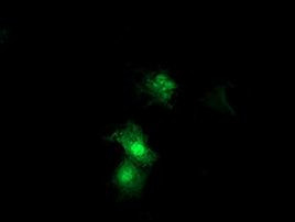 SDS Antibody in Immunocytochemistry (ICC/IF)