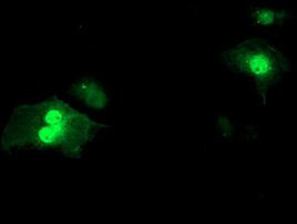 SDS Antibody in Immunocytochemistry (ICC/IF)