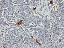 SDS Antibody in Immunohistochemistry (Paraffin) (IHC (P))