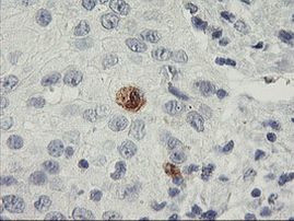 SDS Antibody in Immunohistochemistry (Paraffin) (IHC (P))