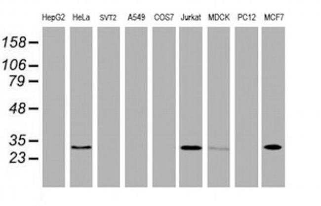 OBFC2B Antibody in Western Blot (WB)