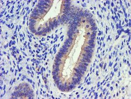 DGKA Antibody in Immunohistochemistry (Paraffin) (IHC (P))