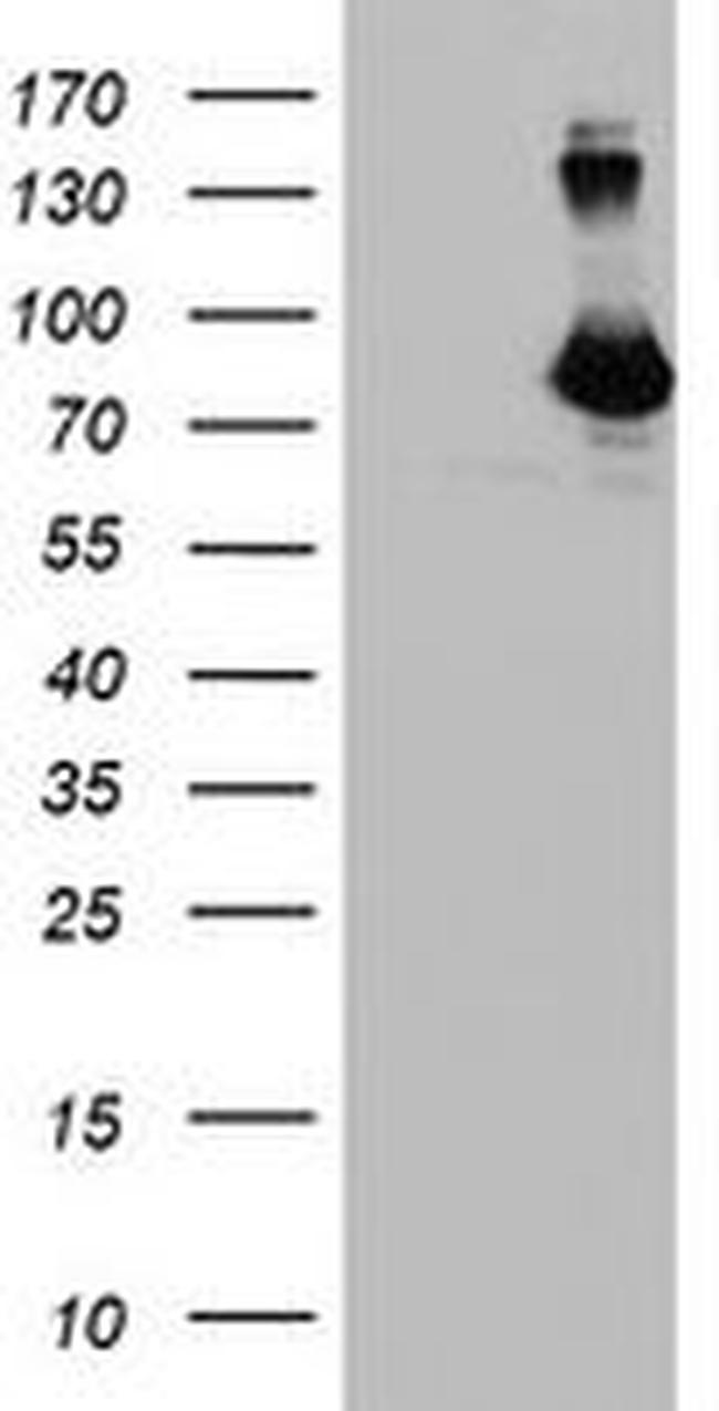 DGKA Antibody in Western Blot (WB)