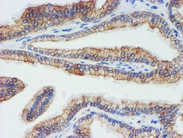 DGKA Antibody in Immunohistochemistry (Paraffin) (IHC (P))