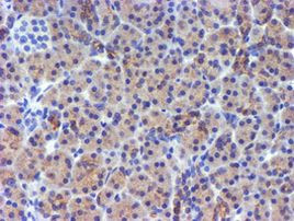 DGKA Antibody in Immunohistochemistry (Paraffin) (IHC (P))