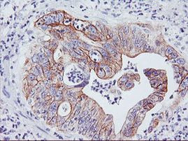 DGKA Antibody in Immunohistochemistry (Paraffin) (IHC (P))