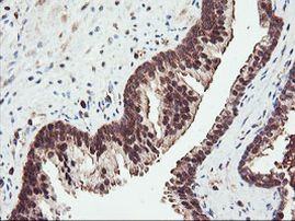 PSMA4 Antibody in Immunohistochemistry (Paraffin) (IHC (P))