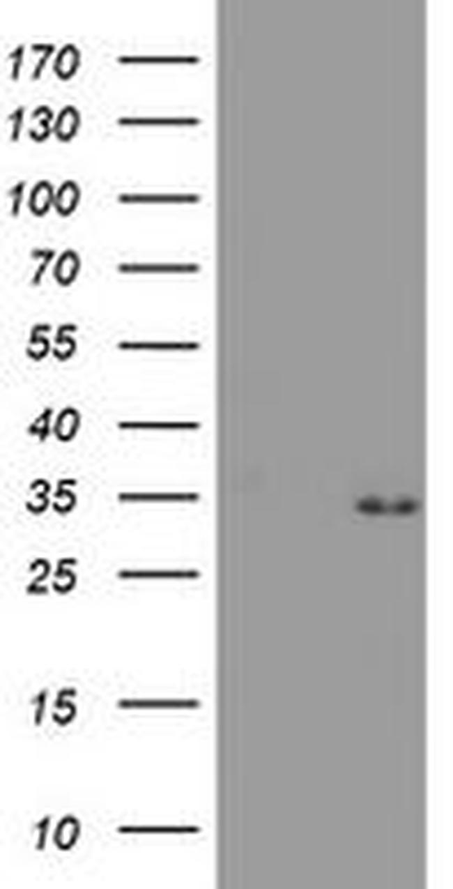 PSMA4 Antibody in Western Blot (WB)