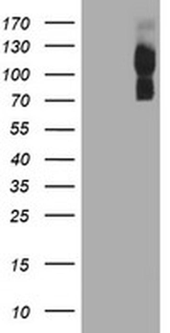 CD249 Antibody in Western Blot (WB)