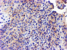 GSTO2 Antibody in Immunohistochemistry (Paraffin) (IHC (P))