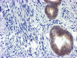 GSTO2 Antibody in Immunohistochemistry (Paraffin) (IHC (P))