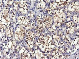 GSTO2 Antibody in Immunohistochemistry (Paraffin) (IHC (P))