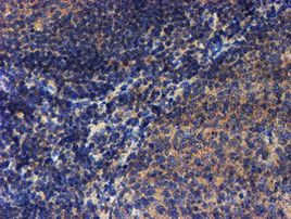 LECT2 Antibody in Immunohistochemistry (Paraffin) (IHC (P))