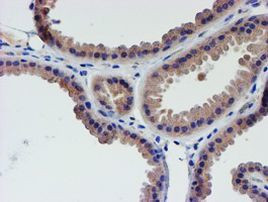 LECT2 Antibody in Immunohistochemistry (Paraffin) (IHC (P))