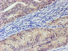 LECT2 Antibody in Immunohistochemistry (Paraffin) (IHC (P))