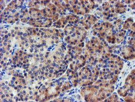 LECT2 Antibody in Immunohistochemistry (Paraffin) (IHC (P))