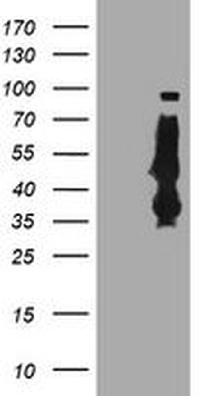 SERPINB6 Antibody in Western Blot (WB)