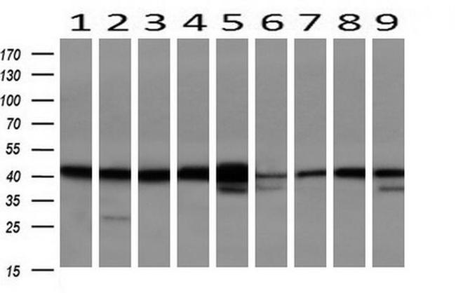 SERPINB6 Antibody in Western Blot (WB)